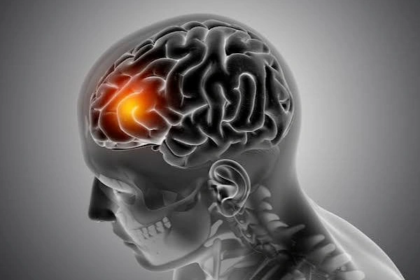 Neurology
